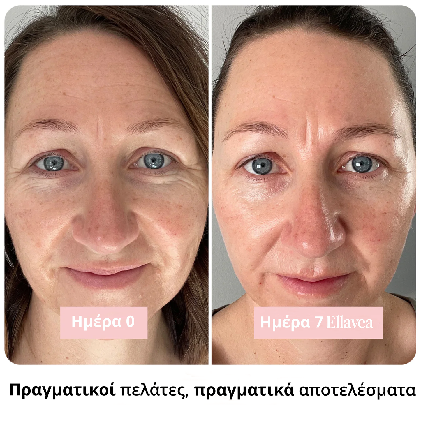 Băț radiant cu colagen