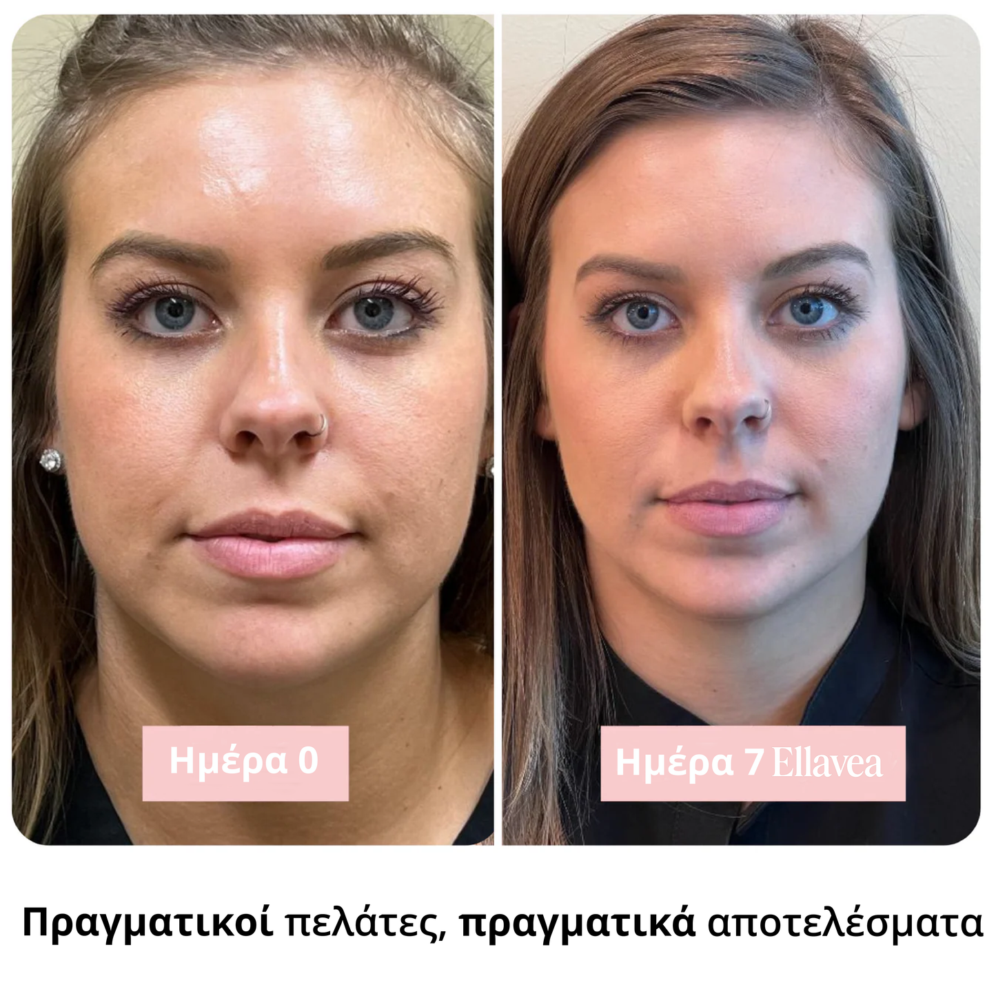 Băț radiant cu colagen