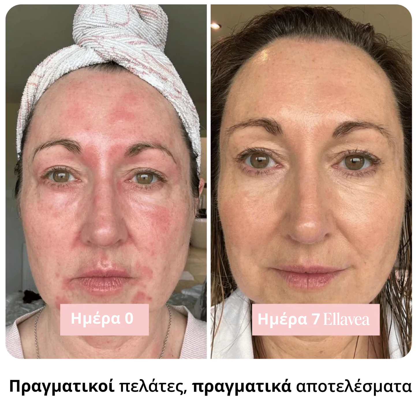 Băț radiant cu colagen